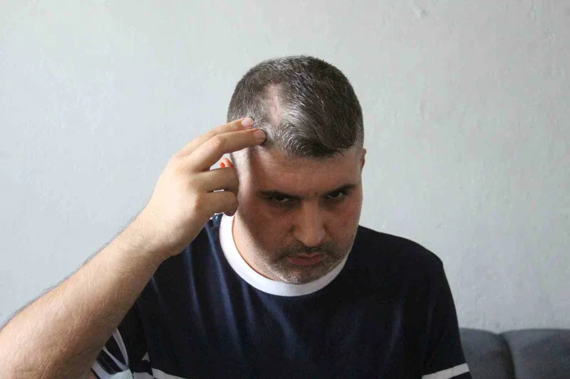 Beyzbol sopalı saldırgan dayı serbest kalınca yeğeni yardım istedi: 