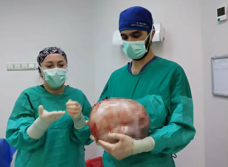 Karnı 2 ayda 9 aylık hamile gibi büyüyen kadının içinden karpuz kadar kitle çıkarıldı
