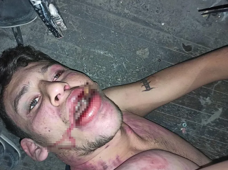 Hamam böceği yedirilen gencin dosyasında karar: Yağmadan beraat, hürriyeti tehditten 6 yıl 12 ay ceza
