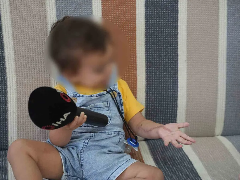 Iğdır’da 1,5 yaşındaki çocuğun tomografi sonrası iki operasyon geçirdiği ve kolunda hasar oluştuğu iddia edildi
