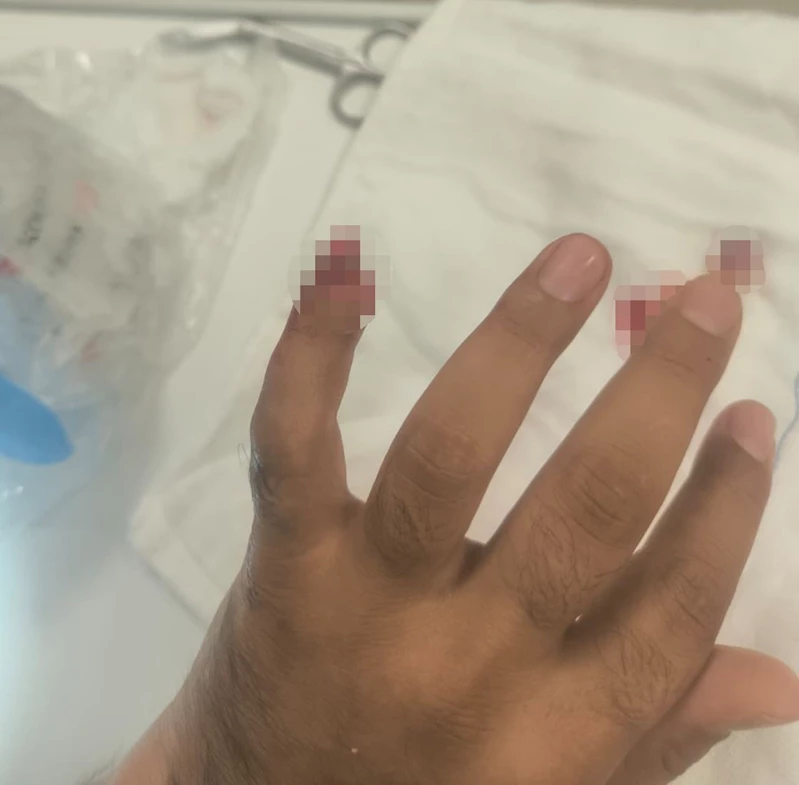 Uyuşturucuyla yakalanan şüpheli, polisin parmağını kopardı
