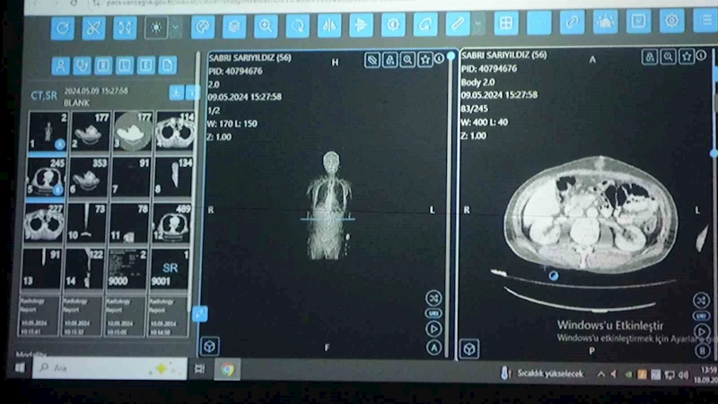 Van’dan dünyaya örnek çalışma: Kanser tedavisinde yapay zekâ kullanıldı
