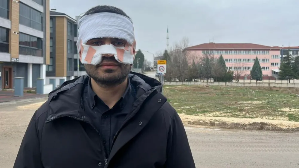 Rehber öğretmeni, meslektaşını yaktı: Okulda akıl almaz saldırı